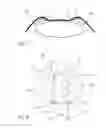 Fig. 05 - Device providing enlargement and preventing collapse of the pupil of the eye