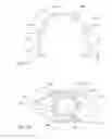 Fig. 07 - Device providing enlargement and preventing collapse of the pupil of the eye