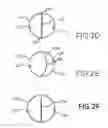 Fig. 04 - MULTI-CHAMBERED CANNULA