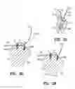 Fig. 10 - Fastener