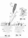 Fig. 12 - Fastener