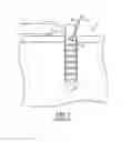 Fig. 02 - Anti-backup suture anchor