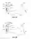 Fig. 10 - Ratchet Controlled Circular Needle Driver