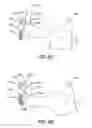 Fig. 11 - Ratchet Controlled Circular Needle Driver