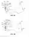 Fig. 10 - Force limited needle driver