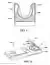 Fig. 10 - Circular needle applier with cleats