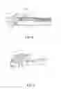 Fig. 06 - Laparoscopic suture device with release mechanism