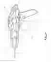 Fig. 30 - Laparoscopic suture device with release mechanism
