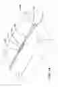Fig. 15 - Suture with trim formed tip