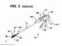 Fig. 04 - Methods and Devices for Reinforcing a Staple Line