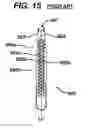 Fig. 14 - Methods and Devices for Reinforcing a Staple Line
