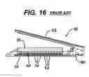 Fig. 15 - Methods and Devices for Reinforcing a Staple Line