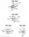 Fig. 34 - Methods and Devices for Reinforcing a Staple Line