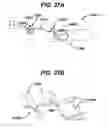 Fig. 36 - Methods and Devices for Reinforcing a Staple Line