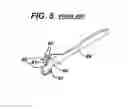 Fig. 06 - Methods and devices for reinforcing a staple line