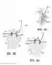 Fig. 10 - Method for securing tissue