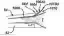 Fig. 01 - Methods and devices for sealing stapled tissue