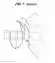 Fig. 02 - Methods and devices for sealing stapled tissue
