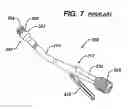 Fig. 08 - Methods and devices for sealing stapled tissue