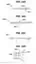 Fig. 22 - Methods and devices for sealing stapled tissue