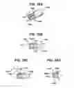 Fig. 34 - Methods and devices for sealing stapled tissue