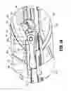 Fig. 12 - Surgical clip applier