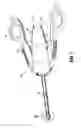 Fig. 02 - Surgical clip applier