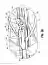 Fig. 12 - Surgical clip applier