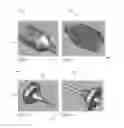 Fig. 07 - Dispensing device and method for delivering filamentary material into a patient