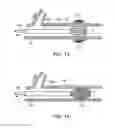 Fig. 08 - LOW RADIAL FORCE VASCULAR DEVICE AND METHOD OF OCCLUSION