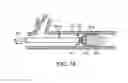 Fig. 10 - LOW RADIAL FORCE VASCULAR DEVICE AND METHOD OF OCCLUSION
