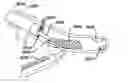 Fig. 01 - Bronchus sealants and methods of sealing bronchial tubes