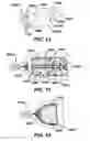 Fig. 08 - Bronchus sealants and methods of sealing bronchial tubes