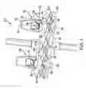 Fig. 02 - Orthopaedic tool cluster clamp and orthopaedic tools
