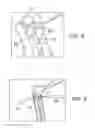 Fig. 05 - ELBOW RECONSTRUCTION INSTRUMENTS