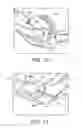 Fig. 10 - ELBOW RECONSTRUCTION INSTRUMENTS