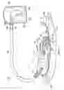 Fig. 02 - Negative pressure tissue debridement devices, systems, and methods