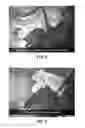 Fig. 05 - Aortic arch reconstruction device and method of using same