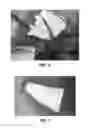 Fig. 07 - Aortic arch reconstruction device and method of using same