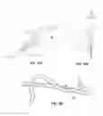 Fig. 13 - Finger-held instrument adapted for supporting or shielding a user's finger
