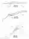 Fig. 17 - Finger-held instrument adapted for supporting or shielding a user's finger