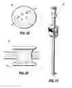 Fig. 12 - SEAL ANCHOR FOR USE IN SURGICAL PROCEDURES