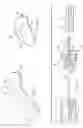 Fig. 02 - Apparatus and methods to communicate fluids and/or support intraosseous devices