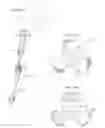 Fig. 06 - Apparatus and methods to communicate fluids and/or support intraosseous devices