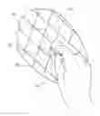 Fig. 01 - Skin abrader
