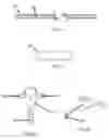 Fig. 03 - Bone fixation system and methods