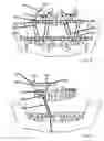 Fig. 05 - Bone fixation system and methods