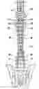 Fig. 01 - Bilateral contoured rod and methods of use