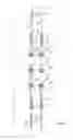 Fig. 03 - Spinal Stabilization