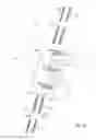 Fig. 16 - Spinal Stabilization